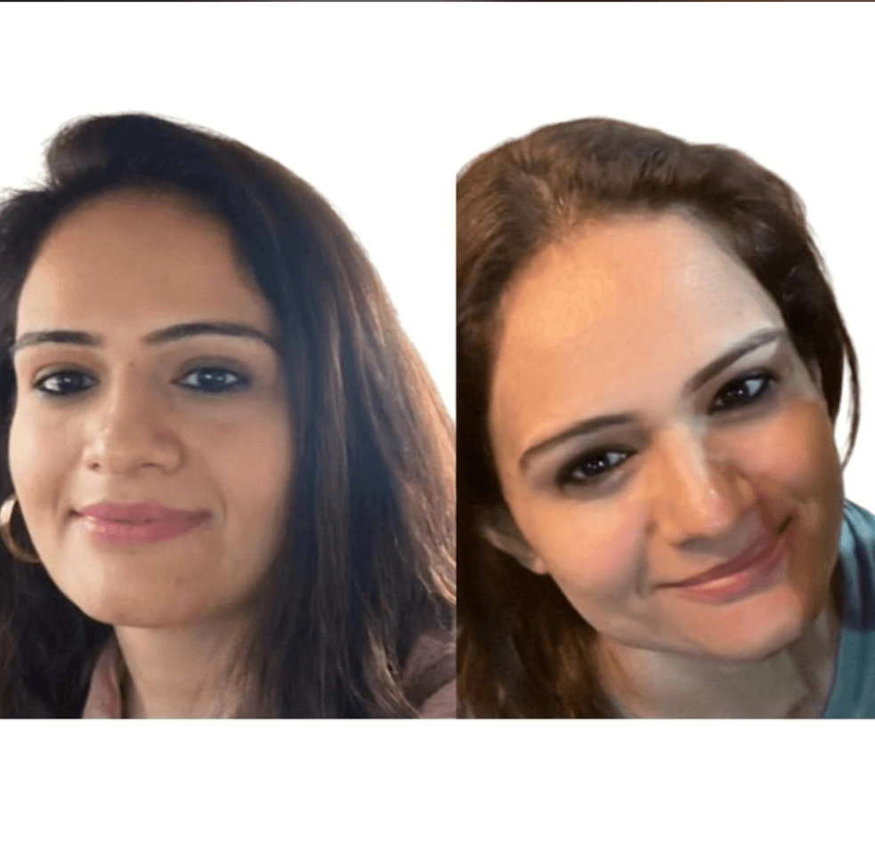 Face transformation — front view before and after
