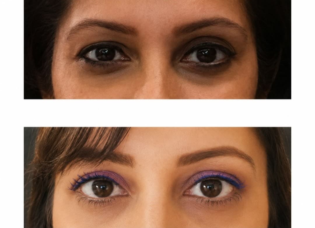 Eye area before and after — reduced puffiness and brighter gaze